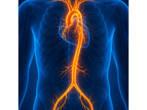 MRT-Angiographie – Radiologischer Befund