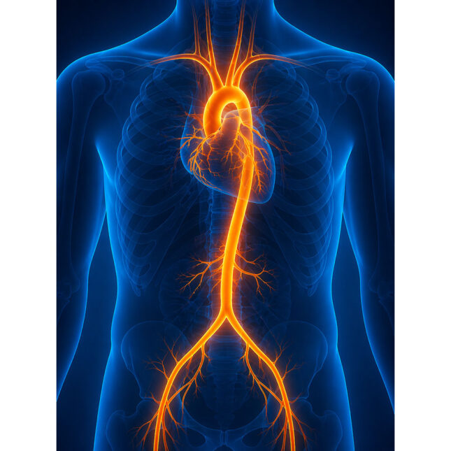 MRT-Angiographie – Radiologischer Befund